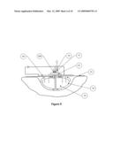 APPARATUS FOR CLEANSING WOUNDS WITH MEANS FOR SUPPLY OF THERMAL ENERGY TO THE THERAPY FLUID diagram and image