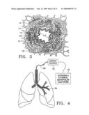 BIPOLAR DEVICES FOR MODIFICATION OF AIRWAYS BY TRANSFER OF ENERGY diagram and image