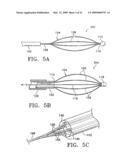 BIPOLAR DEVICES FOR MODIFICATION OF AIRWAYS BY TRANSFER OF ENERGY diagram and image