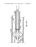 BIPOLAR DEVICES FOR MODIFICATION OF AIRWAYS BY TRANSFER OF ENERGY diagram and image