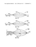 BIPOLAR DEVICES FOR MODIFICATION OF AIRWAYS BY TRANSFER OF ENERGY diagram and image