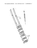 Intramedullary Nail Distal Targeting Device diagram and image