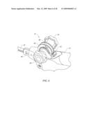 IMPLANT AND DELIVERY SYSTEM FOR SOFT TISSUE REPAIR diagram and image