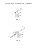 IMPLANT AND DELIVERY SYSTEM FOR SOFT TISSUE REPAIR diagram and image