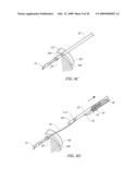 IMPLANT AND DELIVERY SYSTEM FOR SOFT TISSUE REPAIR diagram and image