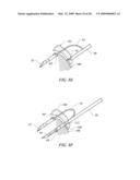 IMPLANT AND DELIVERY SYSTEM FOR SOFT TISSUE REPAIR diagram and image