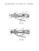 IMPLANT AND DELIVERY SYSTEM FOR SOFT TISSUE REPAIR diagram and image