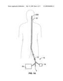 ARTICULATING RETRIEVAL DEVICES diagram and image