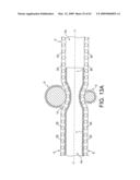 Rotational Atherectomy Device with Distal Protection Capability and Method of Use diagram and image