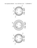 Rotational Atherectomy Device with Distal Protection Capability and Method of Use diagram and image