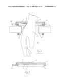 HAND AND INSTRUMENT ACCESS DEVICE diagram and image