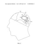 MODULATION AND ANALYSIS OF CEREBRAL PERFUSION IN EPILEPSY AND OTHER NEUROLOGICAL DISORDERS diagram and image