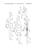 BIFURCATION POST-DILATATION BALLOON AND METHODS diagram and image