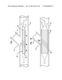 BIFURCATION POST-DILATATION BALLOON AND METHODS diagram and image