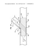 BIFURCATION POST-DILATATION BALLOON AND METHODS diagram and image