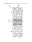 BIFURCATION POST-DILATATION BALLOON AND METHODS diagram and image