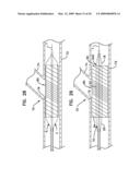 BIFURCATION POST-DILATATION BALLOON AND METHODS diagram and image