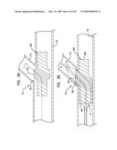 BIFURCATION POST-DILATATION BALLOON AND METHODS diagram and image