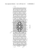 Bifurcated Stent with Open Ended Side Branch Support diagram and image