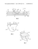 Low Stress Traction System diagram and image