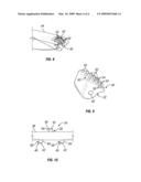 Low Stress Traction System diagram and image