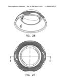 Twist tops diagram and image