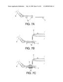 PROCESS FOR OBTAINING A THERMOPLASTIC MATERIAL PRODUCT, AND THE CORRESPONDING PRODUCT diagram and image