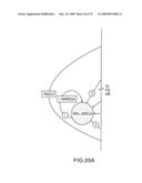 Fibre channel arbitrated loop bufferless switch circuitry to increase bandwidth without significant increase in cost diagram and image