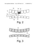 TOOTH WHITENING METHODS AND APPARATUSES diagram and image