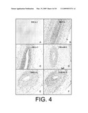 METHOD OF ISOLATION AND USE OF CELLS DERIVED FROM FIRST TRIMESTER UMBILICAL CORD TISSUE diagram and image