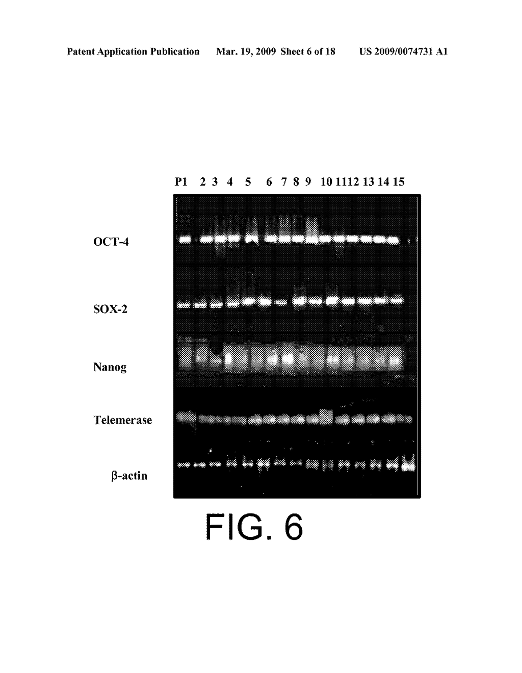 METHOD OF ISOLATION AND USE OF CELLS DERIVED FROM FIRST TRIMESTER UMBILICAL CORD TISSUE - diagram, schematic, and image 07