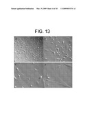 METHOD OF ISOLATION AND USE OF CELLS DERIVED FROM FIRST TRIMESTER UMBILICAL CORD TISSUE diagram and image