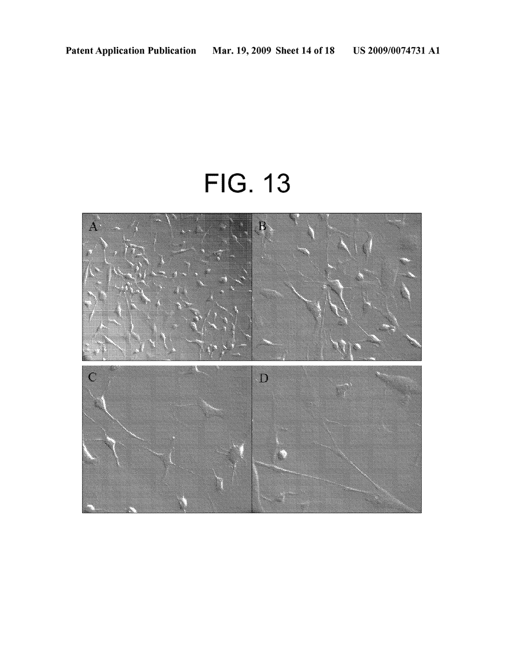 METHOD OF ISOLATION AND USE OF CELLS DERIVED FROM FIRST TRIMESTER UMBILICAL CORD TISSUE - diagram, schematic, and image 15