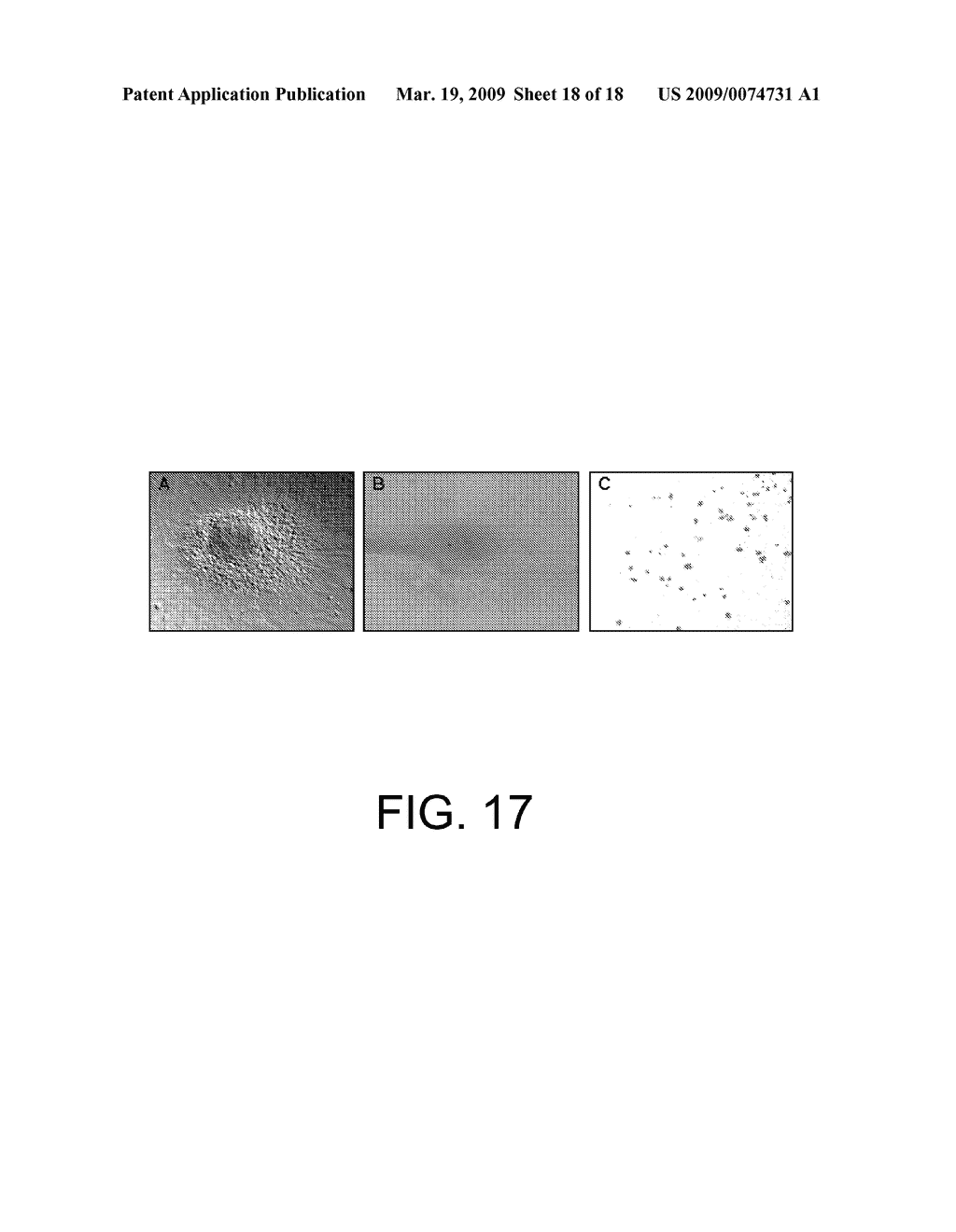 METHOD OF ISOLATION AND USE OF CELLS DERIVED FROM FIRST TRIMESTER UMBILICAL CORD TISSUE - diagram, schematic, and image 19