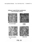 FcGammaRIIB Specific Antibodies and Methods of Use Thereof diagram and image