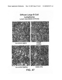 FcGammaRIIB Specific Antibodies and Methods of Use Thereof diagram and image