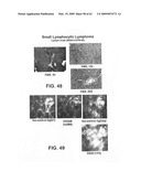 FcGammaRIIB Specific Antibodies and Methods of Use Thereof diagram and image