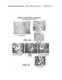 FcGammaRIIB Specific Antibodies and Methods of Use Thereof diagram and image