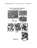 FcGammaRIIB Specific Antibodies and Methods of Use Thereof diagram and image