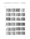 Cancer antigen and use thereof diagram and image