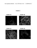 Antibodies against CD38 for treatment of multiple myeloma diagram and image