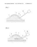 ENDOSCOPIC-USE TREATMENT INSTRUMENT diagram and image