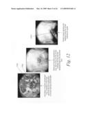 Integrated imaging workstation and a method for improving, objectifying and documenting in vivo examinations of the uterus diagram and image