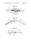 Optimized intravascular ultrasound probe catherers diagram and image