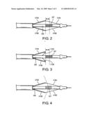 Optimized intravascular ultrasound probe catherers diagram and image