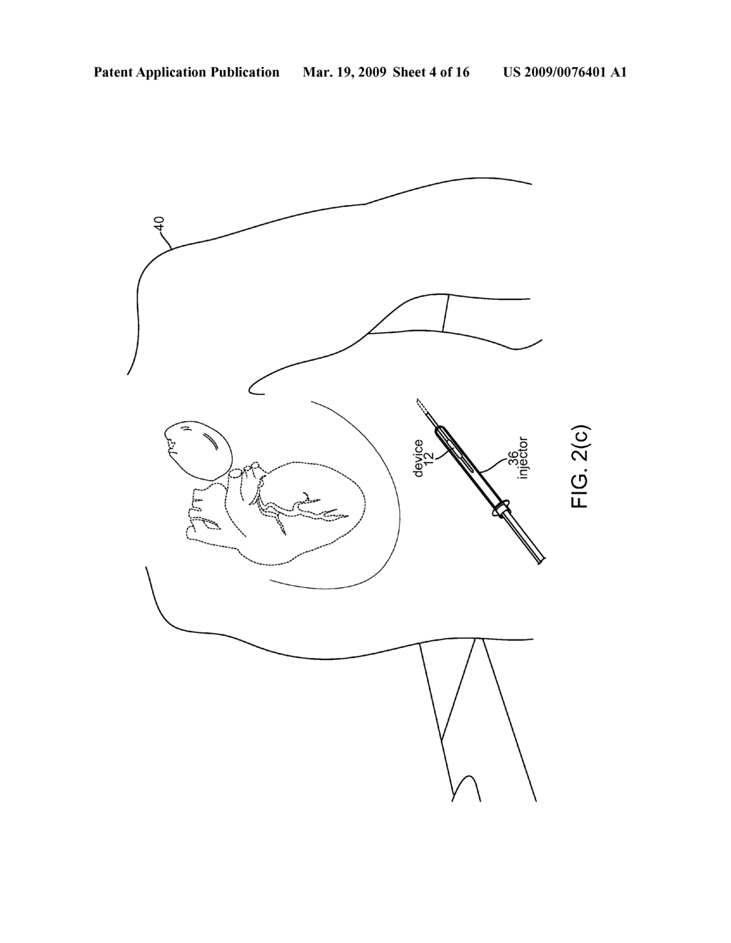 Injectable Physiological Monitoring System - diagram, schematic, and image 05