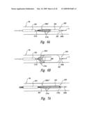 METHODS AND SYSTEMS FOR THERMALLY-INDUCED RENAL NEUROMODULATION diagram and image