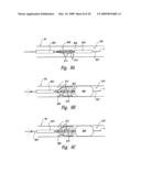 METHODS AND SYSTEMS FOR THERMALLY-INDUCED RENAL NEUROMODULATION diagram and image