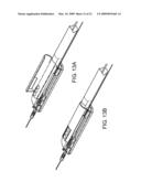 Sterile catheter pullback mechanism assemblies diagram and image