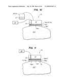 Tissue surface treatment apparatus and method diagram and image